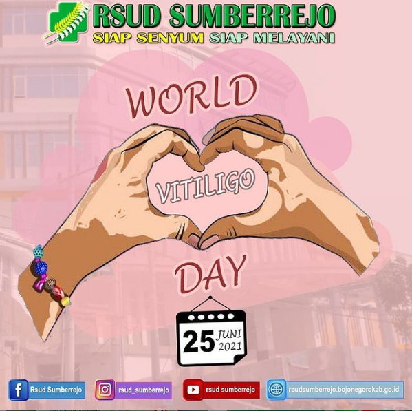 Selamat Hari Vitiligo 25 Juni 2021
